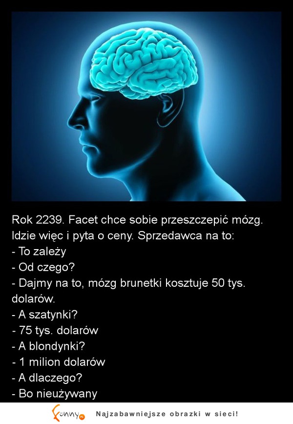 Rok 2239. Facet chce sobie przeszczepić mózg! ZOBACZ jaki najlepszy! haha :D