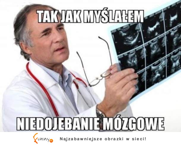 Tak jak myslałem