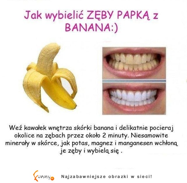 Najlepszy sposób na bielsze zęby! Zobacz najlepszy domowy sposób! To proste ;)