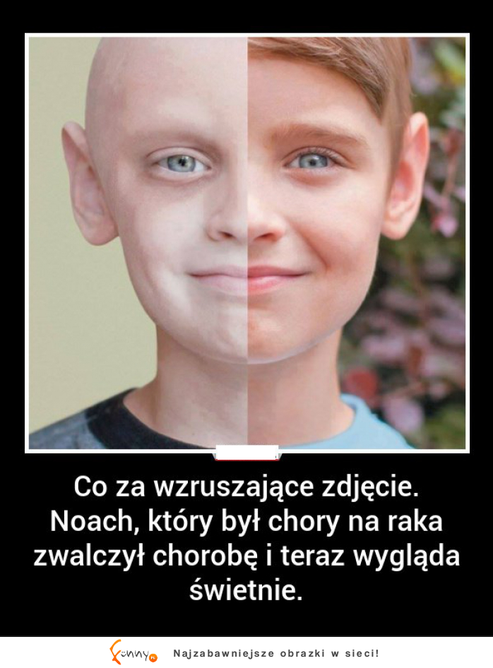 Chłopiec pokonał raka i teraz świetnie wygląda! :)