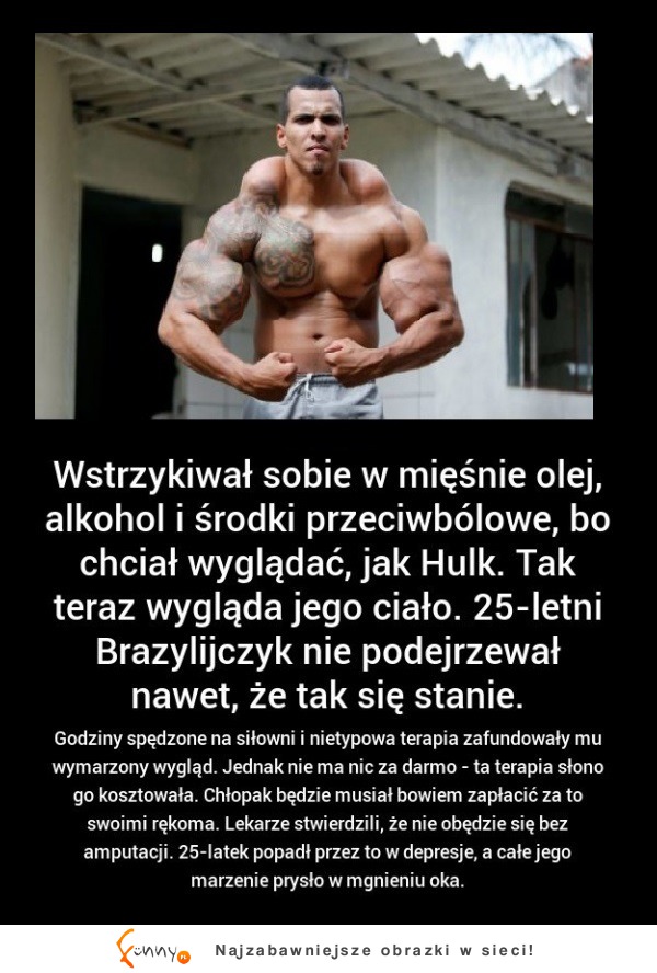 SZOK! Wstrzykiwał sobie OLEJ ALKOHOL i środki przeciwóbolwe bo chciał wyglądać jak HULK! MASAKRA