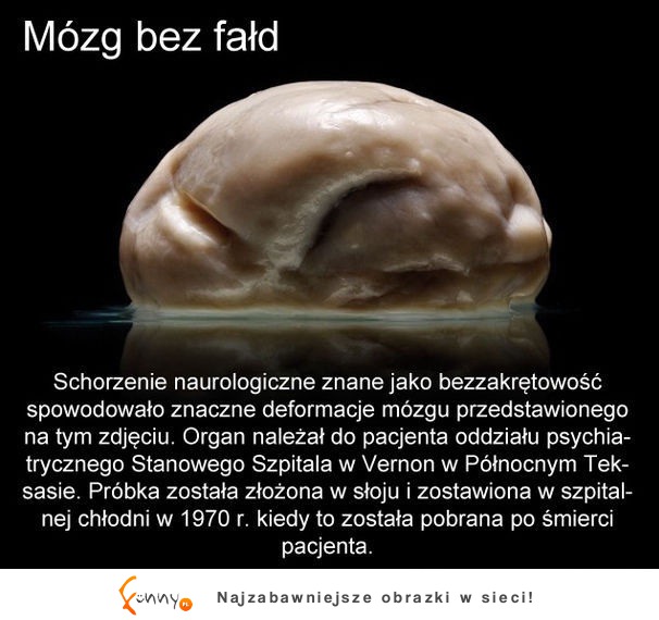 Mózg bez fałd