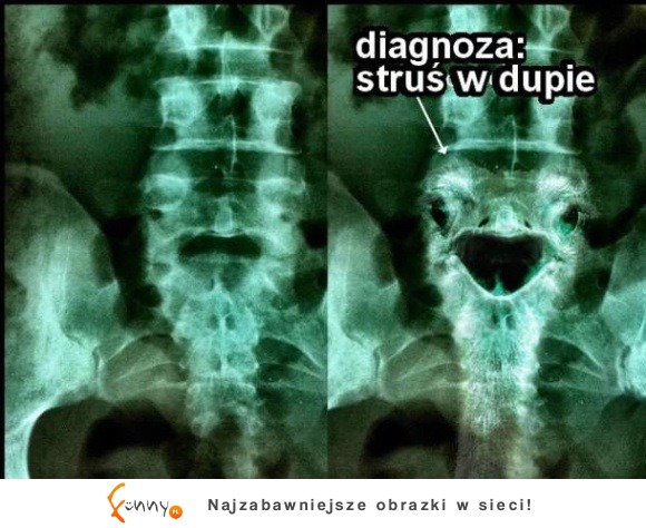 diagnoza: