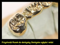 Przychodzi Rusek do dentysty. Dentysta ogląda i widzi same złote zęby! hahah ALE AGENT :D