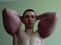 Wstrzykiwał sobie synthol, żeby powiększyć biceps! O mały włos nie zszedł z tego świata!