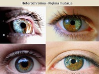 Heterochomia
