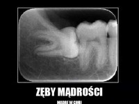 Zęby mądrości