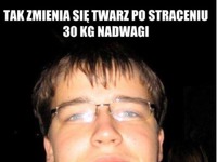 Twarz po straceniu 30kg nadwagi! :O